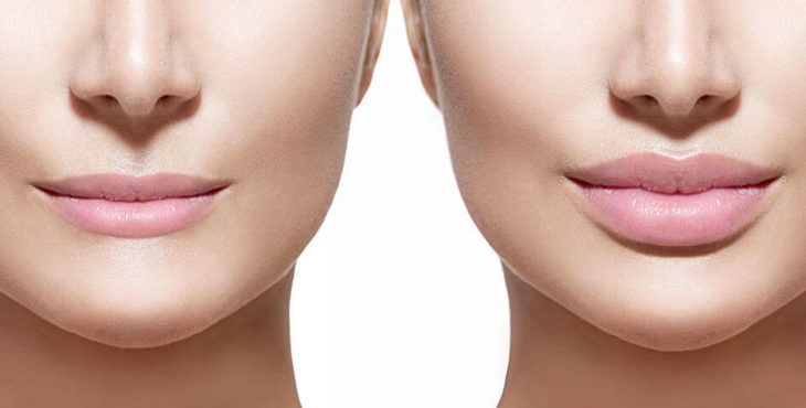 עיבוי שפתיים